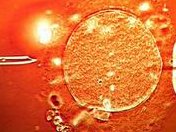 南平第三代试管婴儿价格需要多少钱？