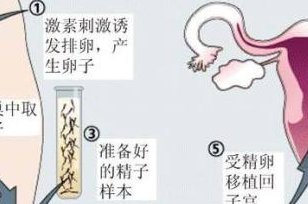 2026年艾滋病患者在银川市妇幼做试管费用贵吗？hiv做试管有哪些条件