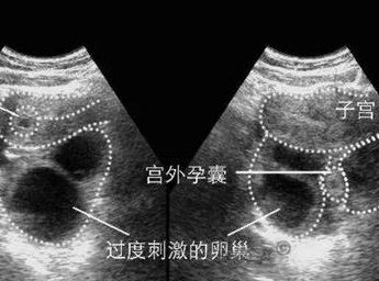 2026年石家庄试管婴儿全攻略，费用预算、成功率一览，轻松备孕不犯愁